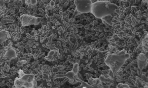  The method for producing hydrogen can also convert the carbon found in biogas and biosolids into advanced carbon nanomaterials, pictured here magnified 50,000 times. 